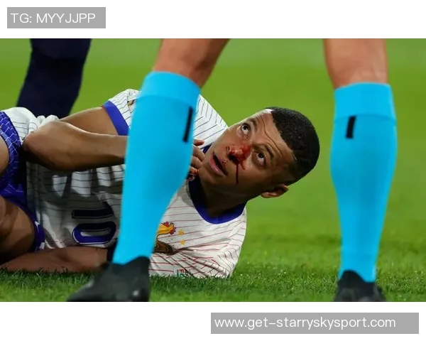 姆巴佩缺席法国训练两天今日将决定是否能参加比赛